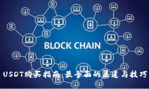 USDT购买指南:最全面的渠道与技巧